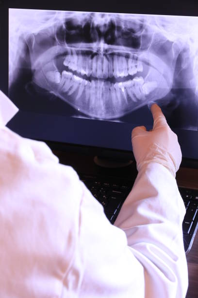 Best Knocked-Out Tooth (Avulsed Tooth) Treatment in Laurel, FL